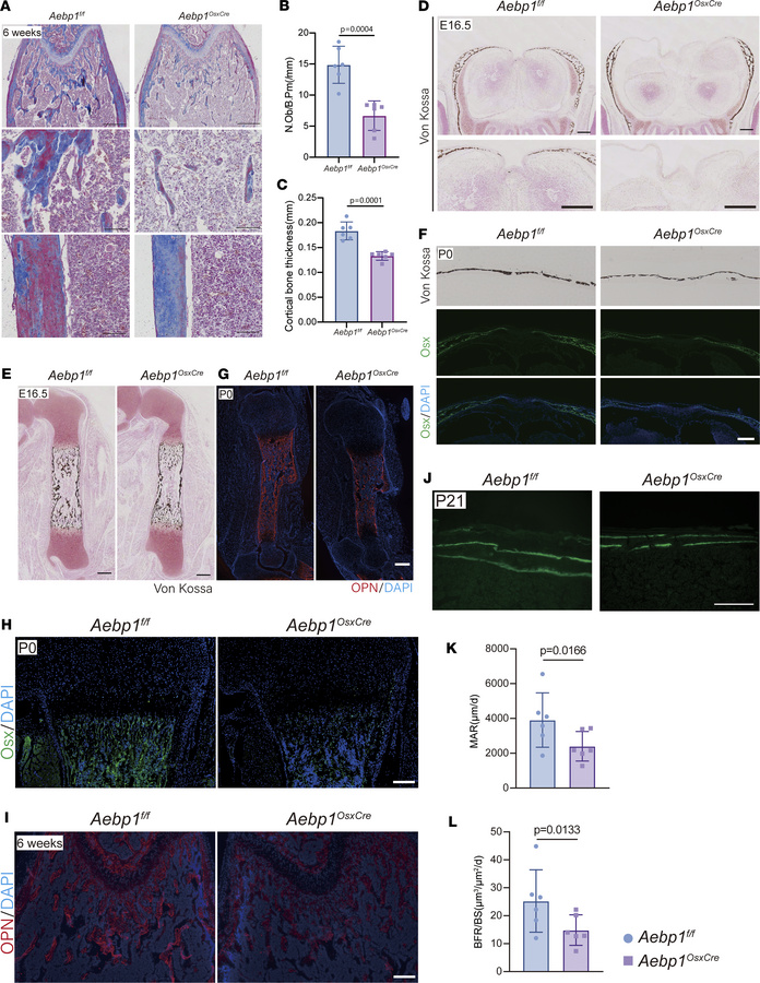 
Aebp1 is required in osteoprogenitor cells for osteoblast differentiati...