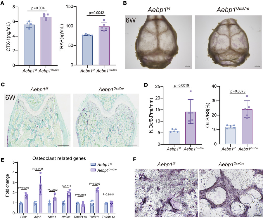 Loss of Aebp1 in mouse osteoblasts led to increased osteoclasts activity...