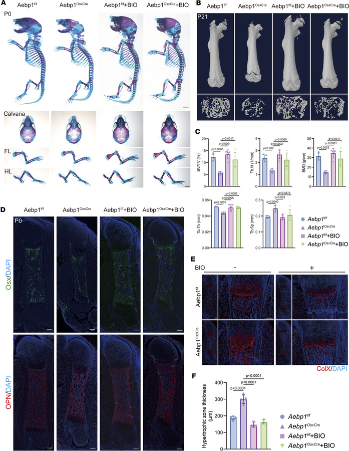 Skeleton defects in Aebp1OsxCre mice were rescued by BIO treatment.
(A) ...