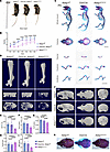 Deletion of Aebp1 in osteoprogenitor cells induced skeletal defects.