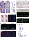 Aebp1 is required in osteoprogenitor cells for osteoblast differentiation a