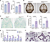 Loss of Aebp1 in mouse osteoblasts led to increased osteoclasts activity.