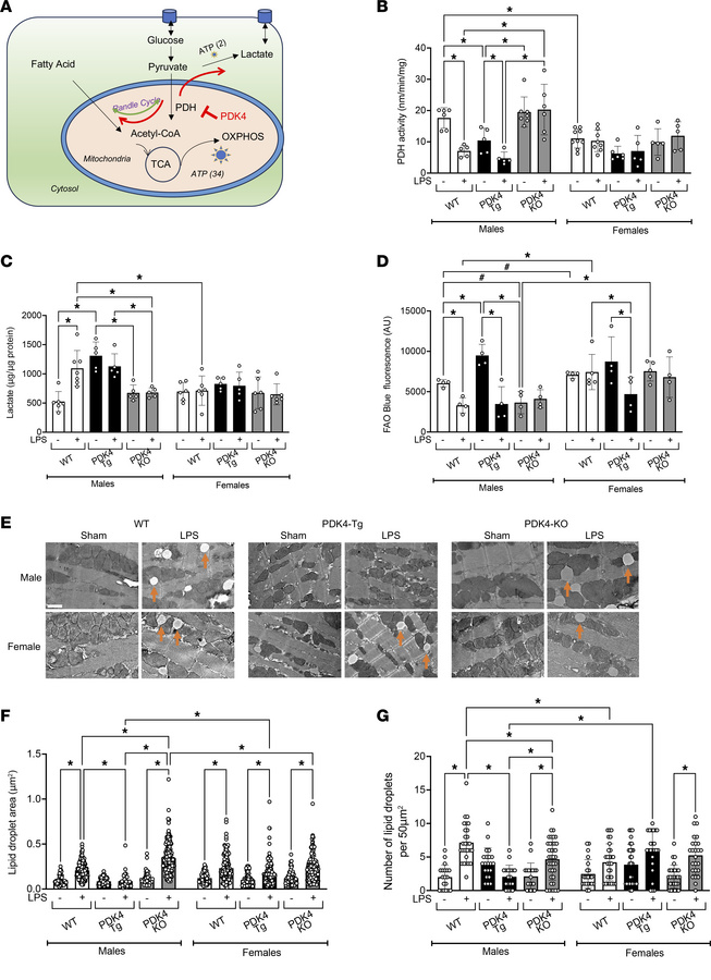 Sex-specific impact of PDK4 on cardiac metabolism.
(A) Schematic illustr...
