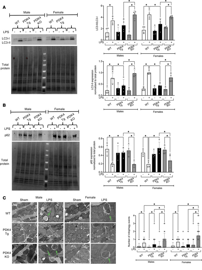 PDK4 impact on cardiac mitophagy.
WT, PDK4-Tg, and PDK4-KO mice were giv...