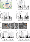 Sex-specific impact of PDK4 on cardiac metabolism.