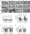 PDK4 impact on mitochondrial structure and morphology in cardiomyocytes.