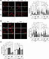 PDK4 impact on mitochondrial health and ROS production in the heart.