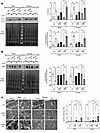 PDK4 impact on cardiac mitophagy.