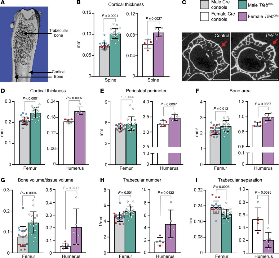 
Tfeb elevation in the osteoblast lineage increases bone mass.
(A) Repre...