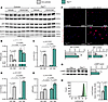 Elevation of TFEB in osteoblasts induces autophagy and lysosomal biogenesis