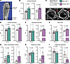 Tfeb elevation in the osteoblast lineage increases bone mass.