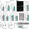Tfeb elevation in the osteoblast lineage increases bone formation.
