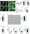 Orai1 knockdown by siRNA on PAH-hPECs reduces pulmonary endothelial dysfunc