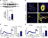 Enhanced Orai1 expression and function in PVOD-hPASMCs and PVOD-hPVSMCs.