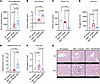 REGN7999 normalizes liver iron loading in Hbbth3/+ mice after 8 weeks.