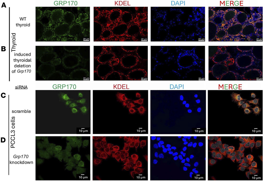 GRP170 is expressed in the ER of thyrocytes.
(A) Immunofluorescence of c...