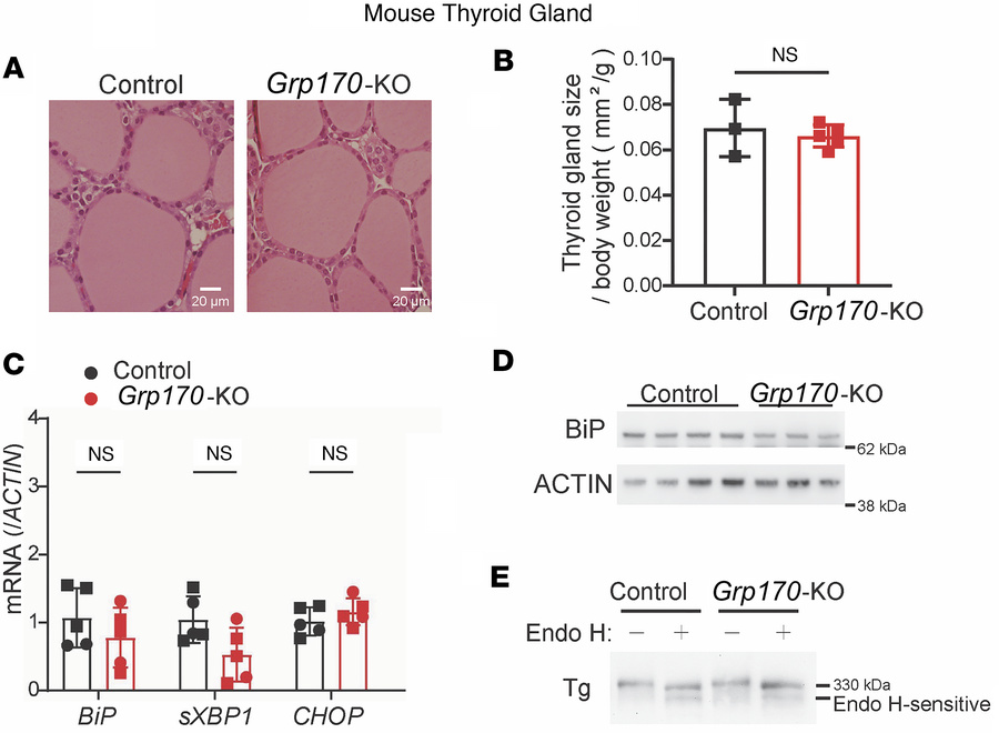 Thyroid tissue response to induced thyrocyte-specific loss of GRP170.
(A...