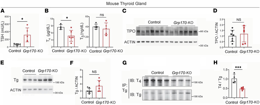 Primary hypothyroidism in mice with deficiency of GRP170 in thyrocyes.
(...