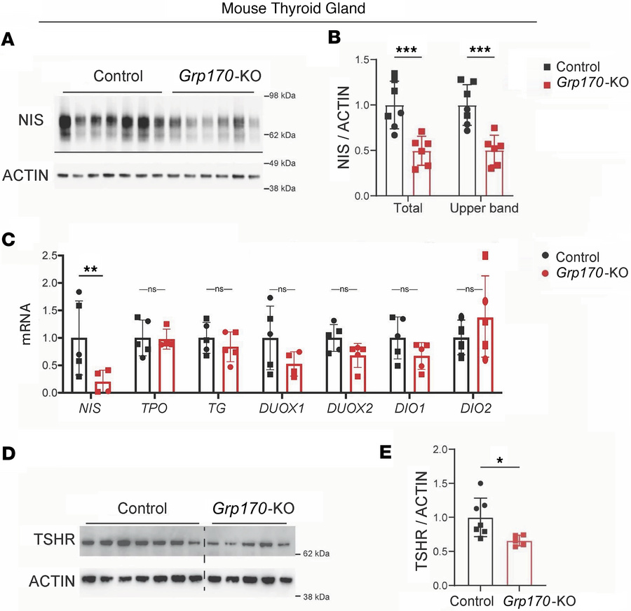 Deficiency of TSH receptors and NIS in the thyroid glands of mice with t...