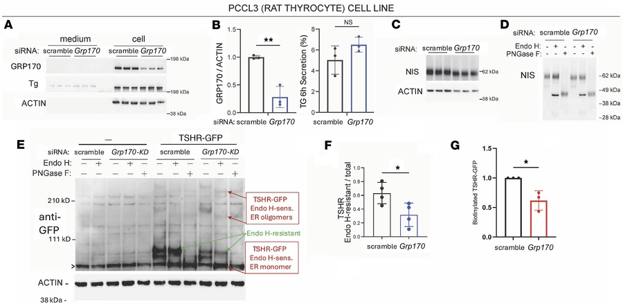 Phenotype of thyrocyte-specific deficiency of GRP170 in PCCL3 cells.
(A)...