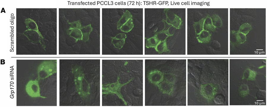 Trafficking of GFP-tagged TSH receptors by live cell imaging in PCCL3 ce...