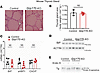 Thyroid tissue response to induced thyrocyte-specific loss of GRP170.