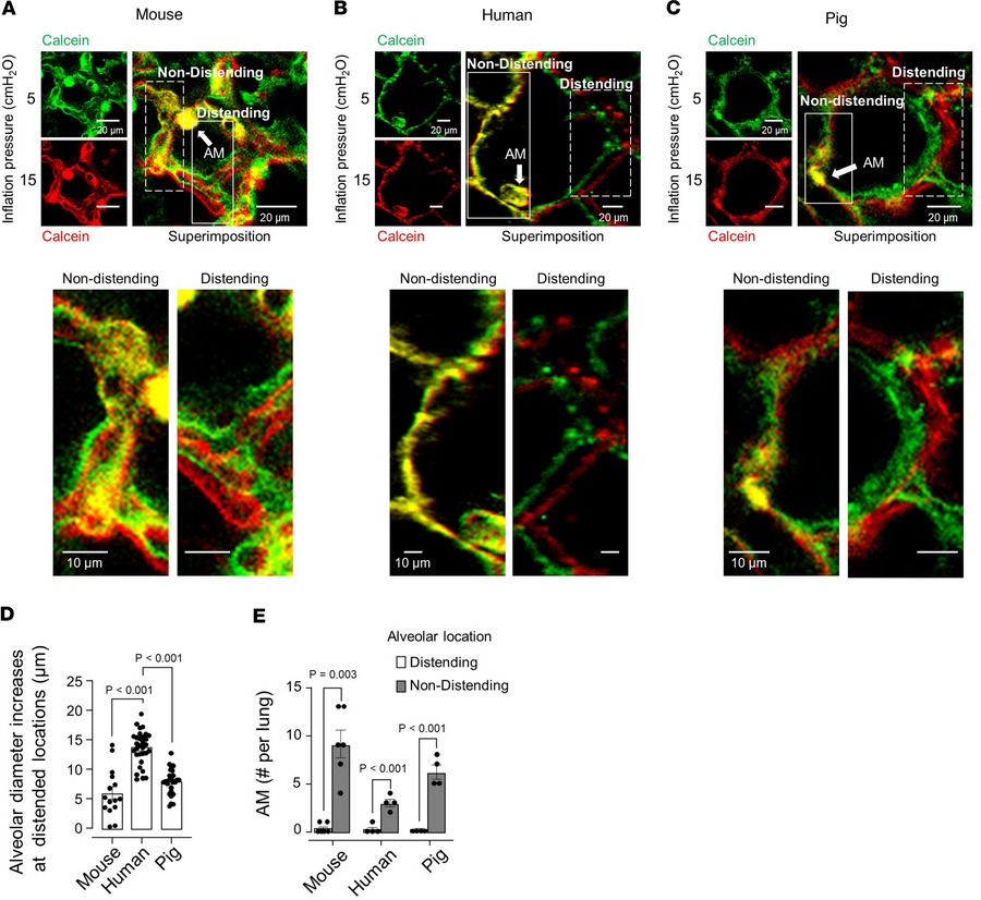 Pseudocolor superimposition by confocal microscopy reveals AMs are locat...