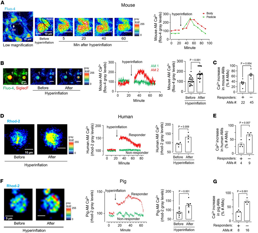 Hyperinflation causes calcium mobilization in mouse, human, and pig sess...