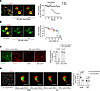Hyperinflation induces TNF-α secretion in sessile AMs.