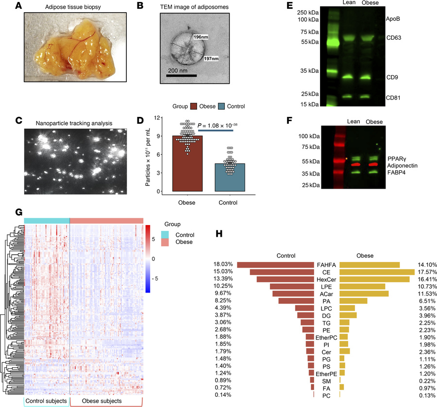 Analysis of adiposomes and lipid alterations in individuals in the obese...