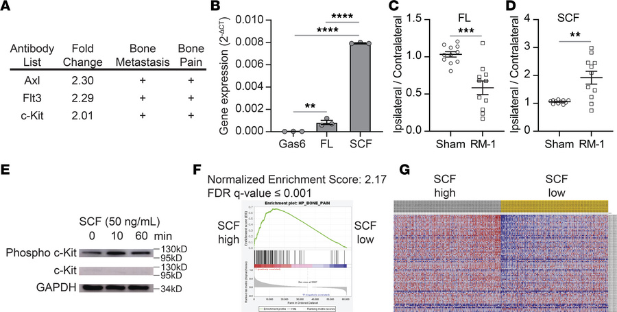 Rationale for studying the SCF/c-Kit axis in CIBP.
(A) Top 3 candidate p...
