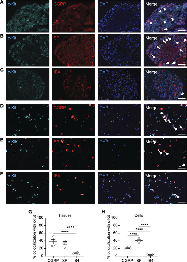 c-Kit is expressed in peptidergic murine DRGs.
Representative IF images ...