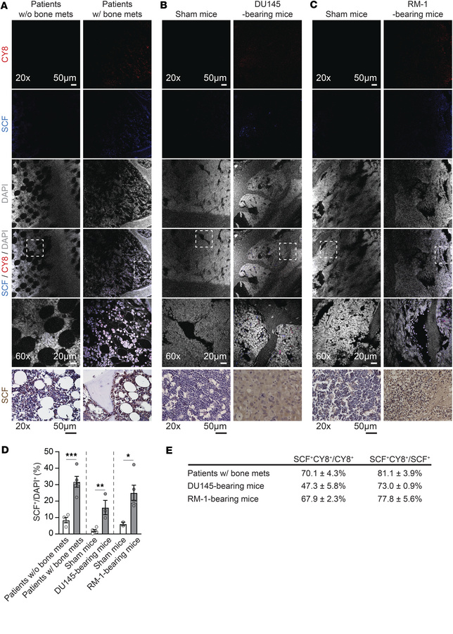 SCF is enriched in bone metastatic cancer cells in the bone marrow.
Repr...