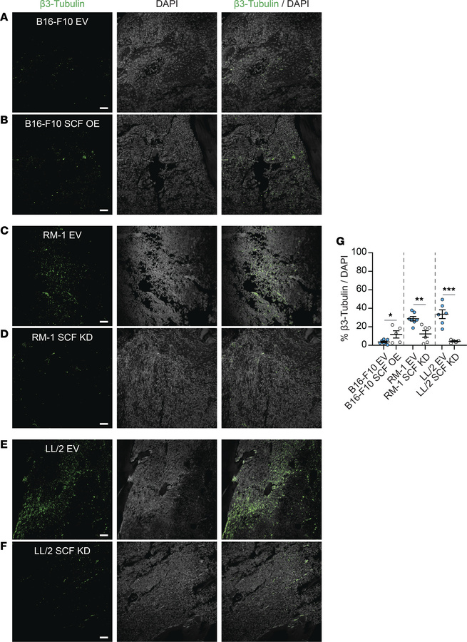 Cancer-derived SCF induces nerve sprouting in vivo.
Representative IF im...
