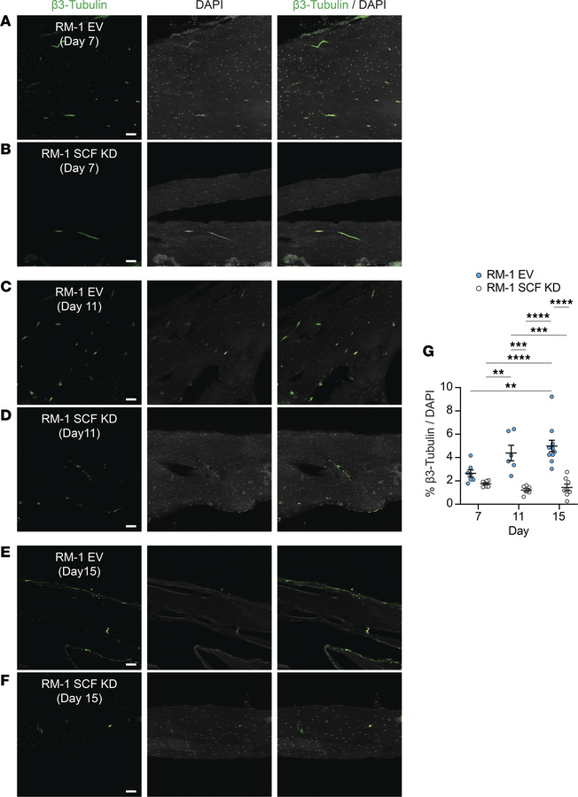Nerve sprouting in the bone induced by tumors with high SCF expression i...