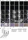 SCF is enriched in bone metastatic cancer cells in the bone marrow.