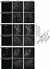 Cancer-derived SCF induces nerve sprouting in vivo.