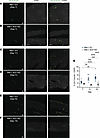 Nerve sprouting in the bone induced by tumors with high SCF expression is a