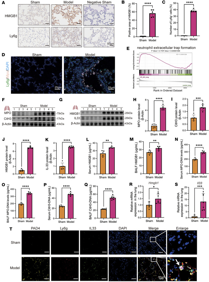 HMGB1 upregulation promotes neutrophil recruitment and IL-33–enriched NE...