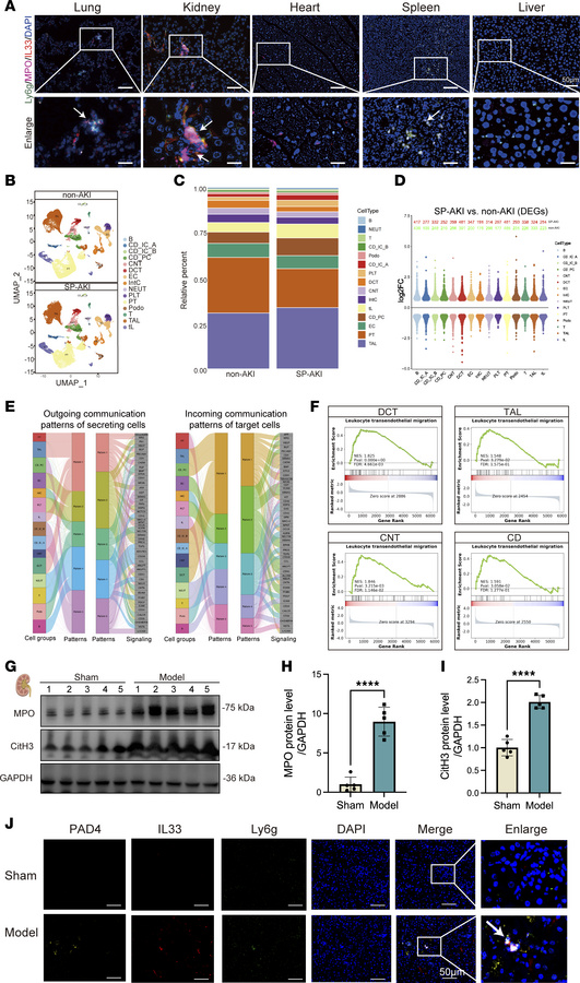Accumulation of IL-33–enriched NETs in SP-AKI kidneys.
(A) Representativ...