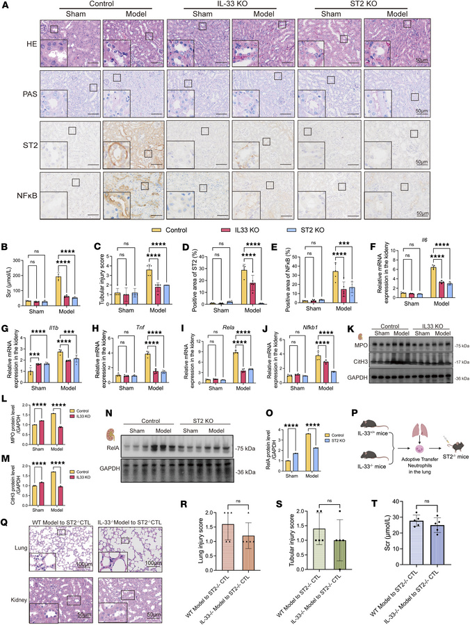 IL-33 and ST2 deficiency suppresses NET formation and NF-κB pathway acti...