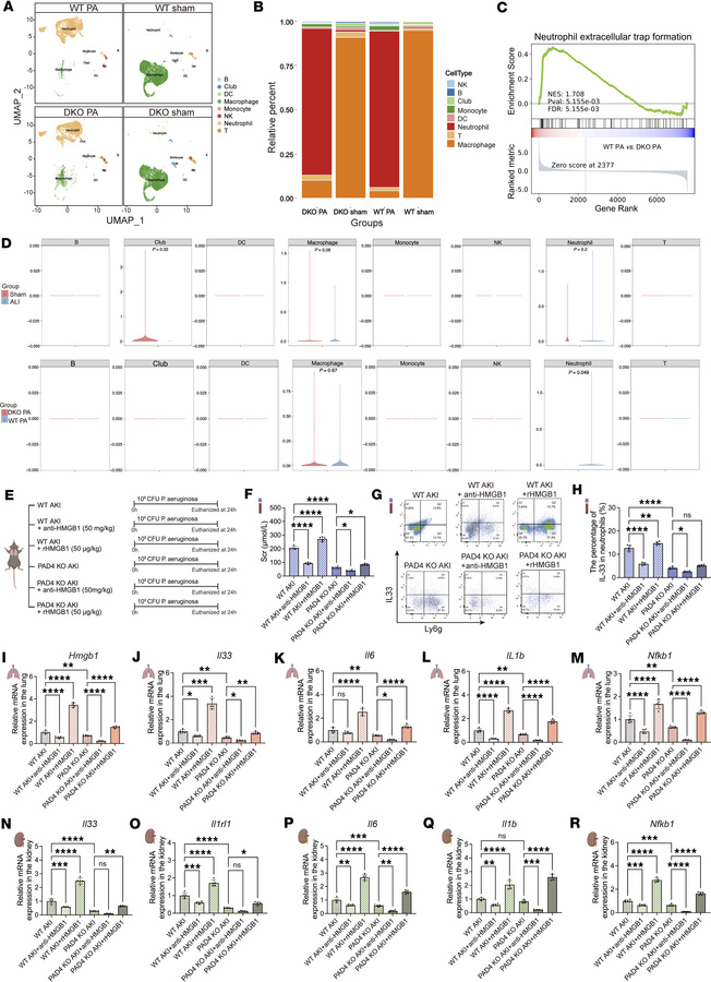 HMGB1 induces IL-33 release and aggravates SP-AKI through PAD4-dependent...