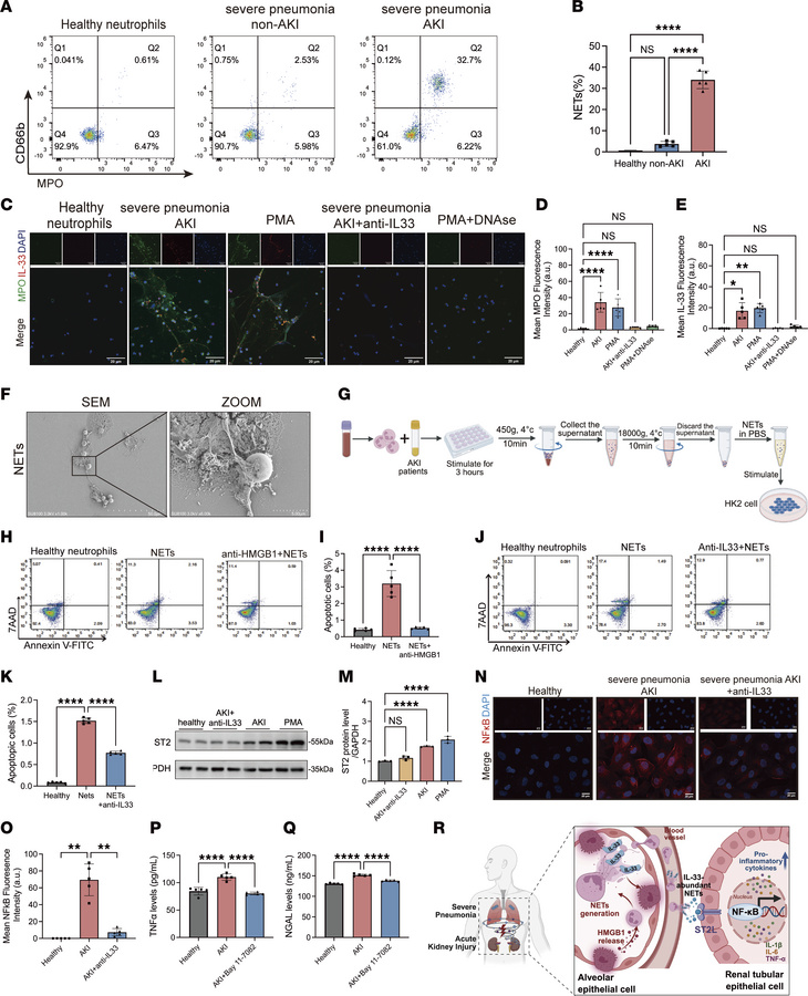 HMGB1/IL-33 neutralization reduces NETs and renal tubular damage in vitr...