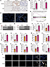 HMGB1 upregulation promotes neutrophil recruitment and IL-33–enriched NET f