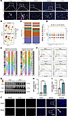 Accumulation of IL-33–enriched NETs in SP-AKI kidneys.