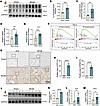 Activation of the IL-33/ST2/NF-κB signaling pathway in the kidneys during S