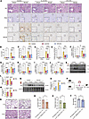 IL-33 and ST2 deficiency suppresses NET formation and NF-κB pathway activat