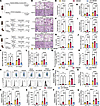 HMGB1 amplifies renal inflammation by enhancing the NET/IL-33/ST2/NF-κB axi