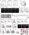HMGB1/IL-33 neutralization reduces NETs and renal tubular damage in vitro.