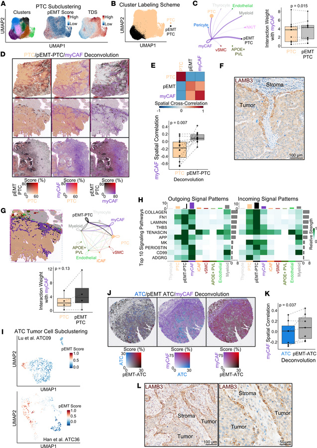 Spatial mapping reveals a pEMT phenotype in invasive tumor cells.
(A) UM...